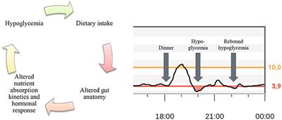 Digital Solutions to Diagnose and Manage Postbariatric Hypoglycemia